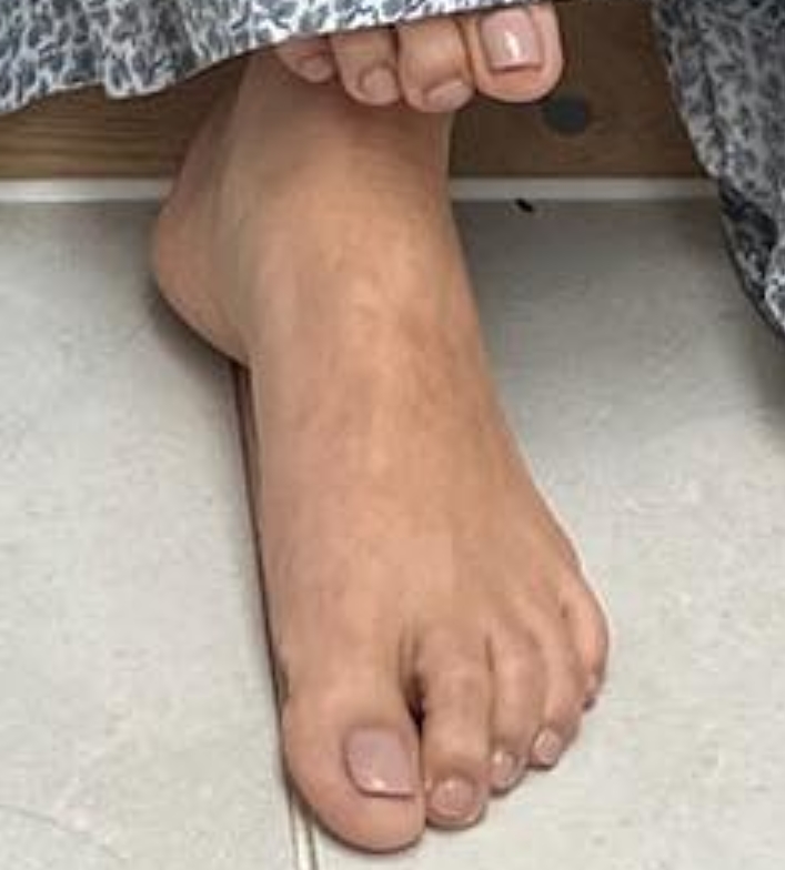Millie Mackintosh Feet